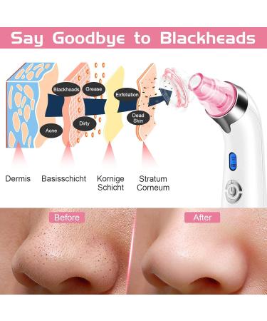 Blackhead Remover Pore Vacuum Facial Pore Cleaner Electric Acne Comedone Whitehead Extractor Tool with 5 Suction Power 4 Probes Blackhead Remover Suction for Women & Men (Pink) - Buy Online on GoSupps.com
