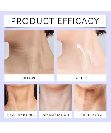 Neck Rejuvenation Cream | Night Cream for Women to Lift Horizontal Lines Lifts Horizontal Lines Moisturizing neck firming cream - Evens Skin Tone Moisturizing Neck Firming Cream for Women and Men - Buy Online on GoSupps.com