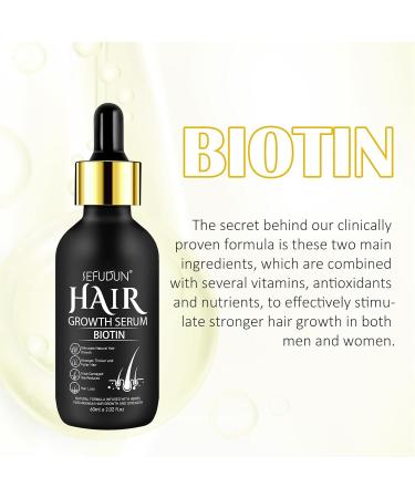 Hair Growth Oil with 5% Biotin - Nourishes Scalp and Stops Hair Loss - Promotes Stronger Thicker Hair for Men and Women Hair Regrowth Treatments with 0.25mm Roller (60ml) - Buy Online on GoSupps.com