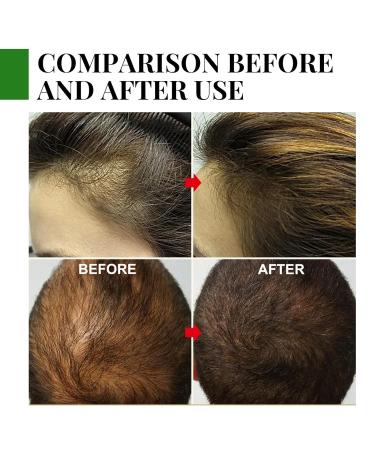 30ml Organic Hair Growth Oil | Essential Rosemary Oil for Men & Women | Nourishing Serum for Scalp & Hair Growth - Buy Online on GoSupps.com