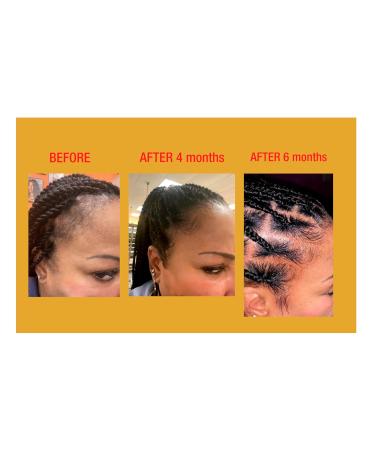Gold Banner Beauty LOC D 4 LYFE Edge Resuscitator 4oz - Hair Loss Treatment for Locs Braids & Wigs | Strengthen & Nourish Edges - Buy Online on GoSupps.com