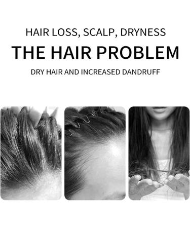 Plant Extract Anti-Hair Loss Hair Shampoo Ginger Anti Hair Loss Shampoo Oil Control Ginger Shampoo Ginger Plant Anti-Hair Loss Hair Shampoo Ginger Shampoo for Women Men Hair 200ML - Buy Online on GoSupps.com