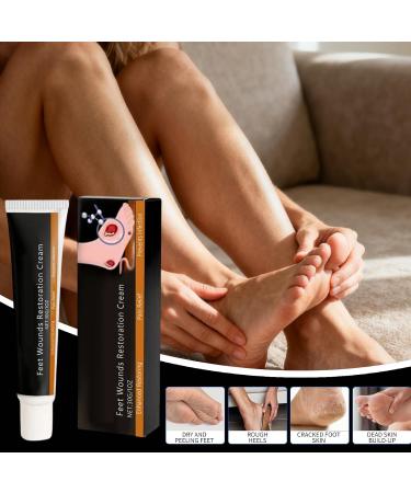  Jingmiger Foot Cream | 30g Natural Softening Moisturizer Repair Lotion For Cracked Heels And Feet | For Hydration Care Sensitive Cracked Heels Adults Sports Daily Night - Buy Online on GoSupps.com