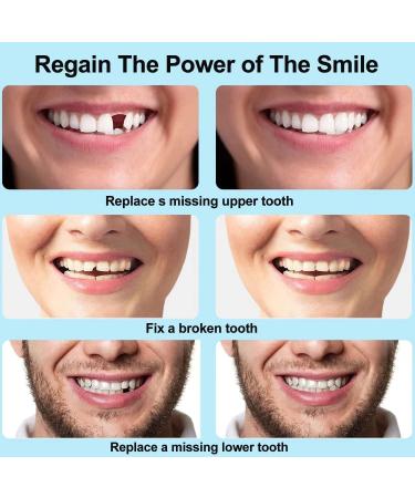 Smile Teeth Veneers - 50 Premium Temporary Crowns for Bad Tooth Coverage | Fast Styling & Healthy Materials | Includes Storage Box - Perfect for Cosmetic Dentistry - Buy Online on GoSupps.com