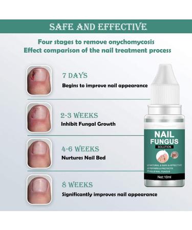 Extra Strong Fungal Nail Treatment for Toenails - Nail Repair Oil for Ingrown Nails - Strengthen and Renew Damaged Nails - 3Pcs Set - Buy Online on GoSupps.com