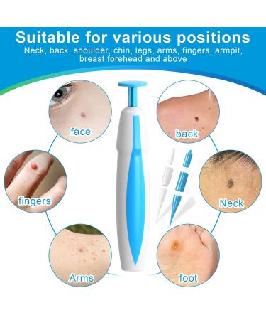 Quick & Painless 2-in-1 Wart Remover Kit for Stem Warts & Fibroma - Effective for All Body Parts - International Shipping - Buy Online on GoSupps.com