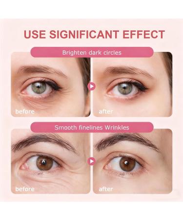 Kcaonni Electric Massage Eye Cream for Dark Circle Polypeptide Eyes Cream with Gentle Vibration Rapid-Absorb Anti-Puffiness Fights Bags Reduces Aging Signs (1PCS) - Buy Online on GoSupps.com