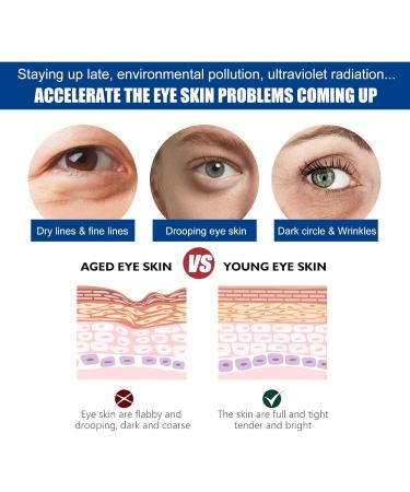 Eye Cream Eye Cream Anti-Wrinkle Eye Cream Repairing Eye Cream for Anti-Puffiness to Reduce Dark Circles Eye Cream Contains Jasmine Extract and Aloe Vera - Buy Online on GoSupps.com