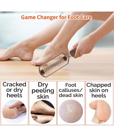 Foot File Professional Pedicure Stainless Steel Detachable Foot Scrubber Callus Remover for feet Foot Scraper Corns Callous Hard Skin Removers Pedicure Rasp for Wet and Dry Feet(Golden) - Buy Online on GoSupps.com
