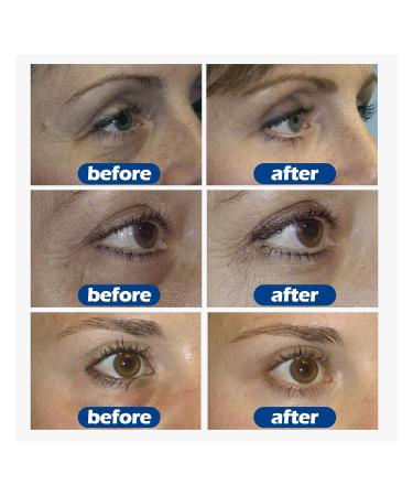 Jasmine Eye Cream - Wrinkle & Dark Circle Treatment Tear Bag Relief - 1PC - Buy Online on GoSupps.com