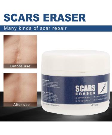 Skin Recovery Scar Gel for Women and Men - Effective Scar Removal Treatment - Buy Online on GoSupps.com