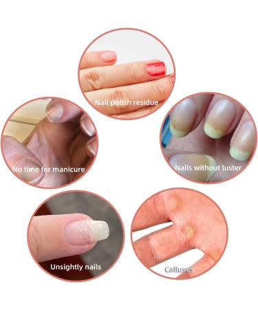 Andrea Mini Nail File 20Pcs 100/180 Grit Nail Buffers for Natural and Acrylic Nails - Professional Manicure/Pedicure Kit for Home and Salon - Buy Online on GoSupps.com