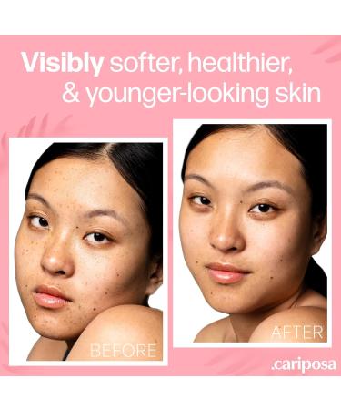 Hyaluronic Acid Serum for Face - Hydrating Pure Formula for Enhanced Skin Texture - 1oz - Buy Online on GoSupps.com