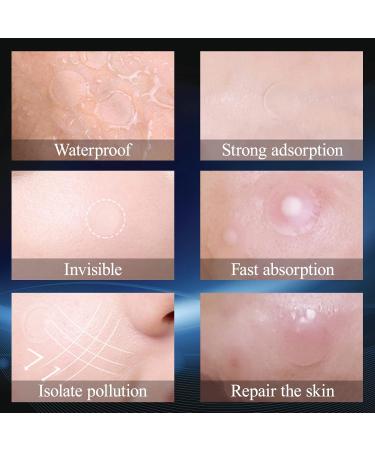252 PCs Sugelary Pimple Patch 2-in-1 Invisible Hydrocolloid Pimple Patches | Effective Anti-Acne Solution (8mm & 12mm) - Fast International Shipping - Buy Online on GoSupps.com