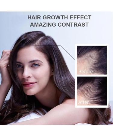 Hppsctink germinal oil 30 ml - Buy Online on GoSupps.com