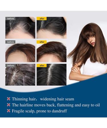 Katutude Hair Regrowth Essence Herbal Hair Growth Serum 40ML Natural Hair Regrowth Lotion Nourishing Serum for Women Men Prevent Hair Loss and Promote Stronger Longer Hair (5 Pack) - Buy Online on GoSupps.com