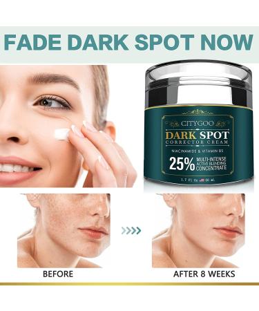 CITYGOO Dark Spot Remover Cream for Face and Body - Natural Ingredients for Melasma, Freckles, Sun Spots - 1.7 FL OZ - Buy Online on GoSupps.com