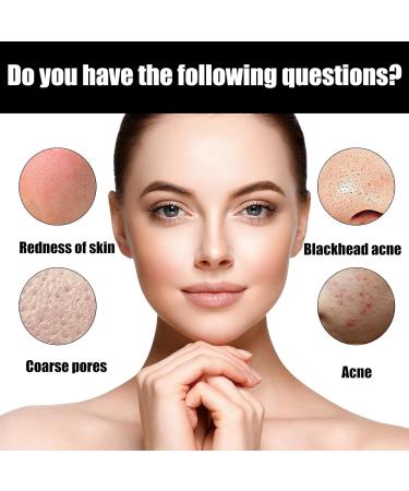 Lactic Acid 10% + Hialuronyc Acid 10% Exfoliating Serum 10% Lactic Acid Serum with Hyaluronic Acid Serum Lactic Acid Serum Face Serum for Women Hydrating Serum Brightening Serum Skincare 30ml - Buy Online on GoSupps.com