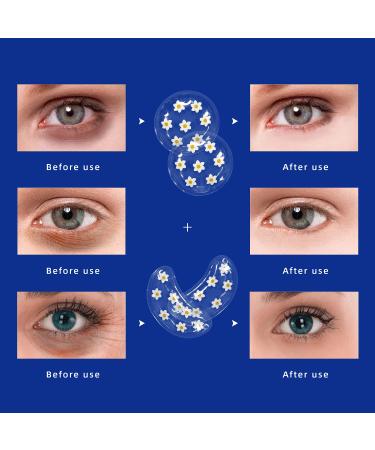 Reusable Gel Eye Pads - Cooling Eye Treatment Pack for Pain Relief & Relaxation - Buy Online on GoSupps.com