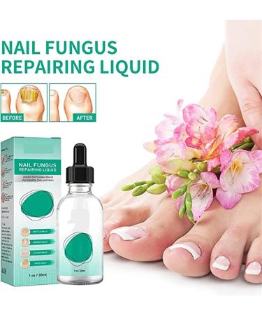 Fungus Treatment Oil Foot Fungus Oil Kerasentials Nail Treatment Healthy Natural Repair Nails Natural Toenail for Damaged & Discolored Toe Nails (2pcs) - Buy Online on GoSupps.com