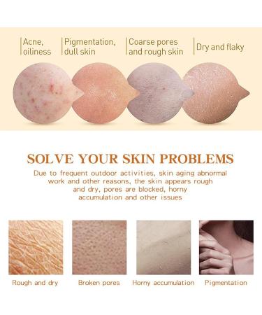 Niacinamide Body Scrub - Flower Fragrance Body Scrub Exfoliator - Niacinamide Exfoliating Body Scrub - Deep Cleansing Refine Pore Moisture Hydrating - Improve Dullness Restore Smooth Skin Elasticity - Buy Online on GoSupps.com