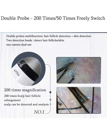 Skin Diagnosis Hair Analyzer - 5 in 1 WiFi 5G 1000w Pixels 50x/200x Lens for Home Beauty & Hair Care - Buy Online on GoSupps.com