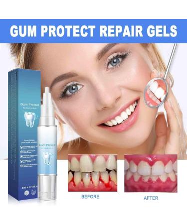 SRBIRD Gum Protect Repair Gel gum repair gel for healthy gums natural care immediate soothing and whitening effect gentle and effective A AX1 - Buy Online on GoSupps.com