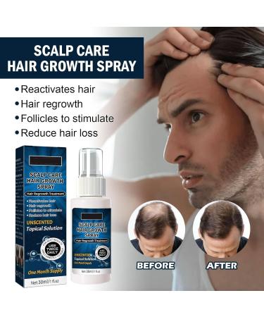 East Moon Scalp Care Hair Growth Spray - 30ml Anti-Shedding Serum for Women & Men | Boost Healthy Hair Growth Internationally - Buy Online on GoSupps.com