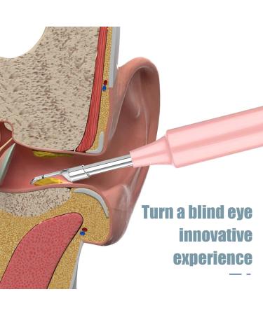 Buy Risegun Z10 WiFi Visual Ear Pick - 4.3mm HD Smart Ear Cleaning Camera - Effective Ear Wax Removal Tool (Pink) - Fast International Shipping - Buy Online on GoSupps.com