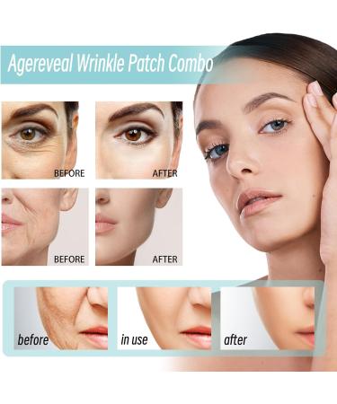 Face Wrinkle Patches Face Lifting Patches Face Lift Tape Anti Wrinkle Patches Reusable Silicone Wrinkle Pads Face Tape For Wrinkles Silicone Face Patches for Skin Lines Prevention - Buy Online on GoSupps.com