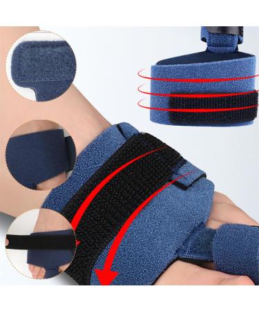 Toe Splints for Hammertoes - Pain Relief & Support | Toe Straightener Brace for Men & Women (2 Pcs - Buy Online on GoSupps.com