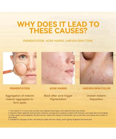 Vitamin C Moisturiser For Face Cream Face Moisturiser Vitamin C Facial Moisturiser Day And Night Cream For Women Brighten Tone Face Brightening Cream Brighten Anti Wrinkle Cream Skin Lightening Cream - Buy Online on GoSupps.com
