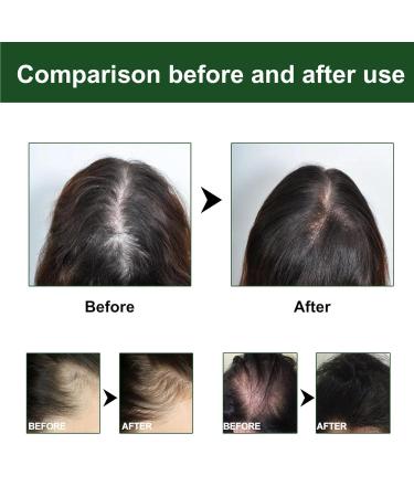 Rosemary Oil for Hair Growth | Natural Fertilizer for Dry & Damaged Hair | 60ml Essential Oil - Nourish Scalp & Combat Hair Loss - Buy Online on GoSupps.com