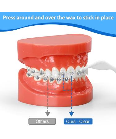 Braces Wax 10 Pack with 50 Precut Wax Strips - Food-Grade Dental Wax for Braces & Aligners - Mint+Aloe Vera+Vitamin E - Stick Better - Includes Storage Box & Applicator Tools - Buy Online on GoSupps.com