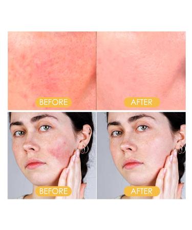 AKARY SPF 50 Sunscreen Setting Powder | Lightweight Water-Resistant Face & Body Sun Protection | Ideal for Beach & Daily Use - Buy Online on GoSupps.com