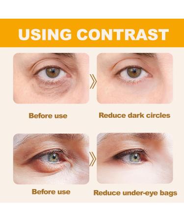 Anti-Wrinkle Eye Essence Oil Lutein Eye Essence Oil Hydrating Dark Circles Remover for Daily Eyes Care 2PCS - Buy Online on GoSupps.com