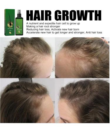 Shantou Yingji Nourishing Ginger Nourishing Spray Ginger Hair Growth Serum AntiHair Loss 2 Pieces x 120 ml - Buy Online on GoSupps.com