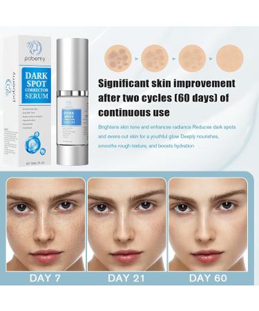 Dark Spot Remover for Face & Body | Niacinamide Hyaluronic Acid Vitamin E | Rapid Tone Repair Cream - Buy Online on GoSupps.com