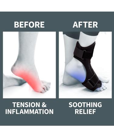 AZMED 2020 Plantar Fasciitis Night Splint - Adjustable, Lightweight, and Breathable Foot Brace for Achilles Tendonitis Relief and Arch Pain Support - Easy to Wear - Fits Most Feet - Black - Buy Online on GoSupps.com