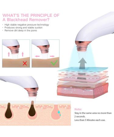 Visual Blackhead Remover Vacuum with Camera | 3 Adjustable Suction Levels | 5 Replacement Probes | USB Rechargeable - Gold - Buy Online on GoSupps.com