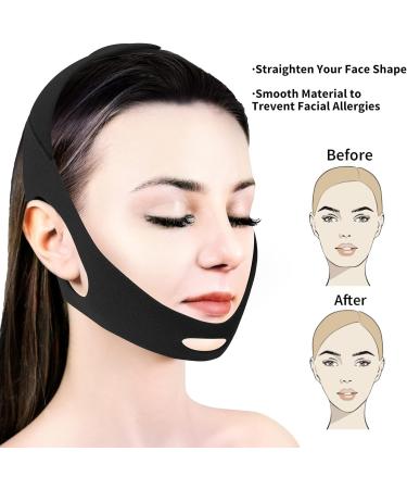 2023 Upgraded Adjustable Anti Snoring Chin Strap - Stop Snoring & Dry Mouth - Sleep Aid Device for Men and Women (Black) - Buy Online on GoSupps.com