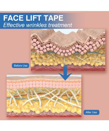  Face Tape for Wrinkles - Reusable V Face Smoothing Patches for Forehead & Chest - Self Care Wrinkle Solutions - 2.5CM x 1000CM  - Buy Online on GoSupps.com