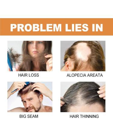 KOAHDE Against hair loss for women and men hair growth serum 2 ml x 7 pieces hair nutrients moisture care scalp massage fluid - Buy Online on GoSupps.com