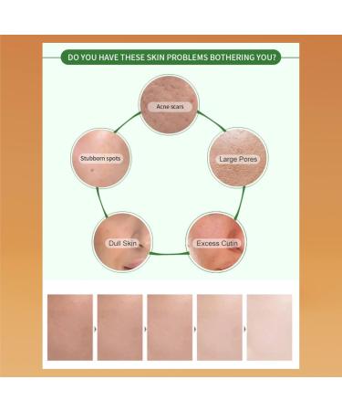 Pack of 13 Hydrating Facial Masks - Orange Strawberry Lemon Honey & More - Revitalize Your Skin - Buy Online on GoSupps.com