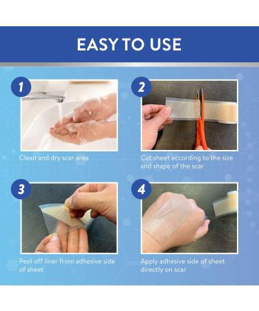 Retailio Silicone Scar Sheets - Soften, Flatten Scars, C-Section, Keloid Surgery - Reusable, Washable - 1.6x60 - Buy Online on GoSupps.com