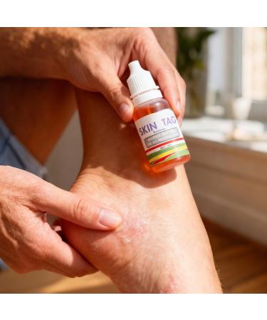 Mole Remover for the Body - 25g Blemish Correcting Liquid Solution | Mole Removal Solution - For Women At Home While Traveling Routine - Buy Online on GoSupps.com