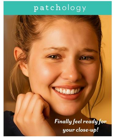 Patchology S.O.S. Overnight Acne Solution Gel-to-Patch Clarifying Liquid Patch 2.9% Sulfur 3% Niacinamide Dries Clear Fast Results Makeup Safe Pregnancy Safe Face & Body Use - Buy Online on GoSupps.com