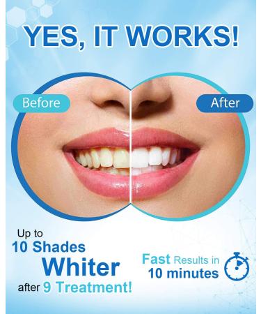 MySmile Teeth Whitening Pen for Sensitive Teeth | Fast Results 35% Carbamide Peroxide Gel | Whitening Refill for Year Stains | 1 Count - Buy Online on GoSupps.com