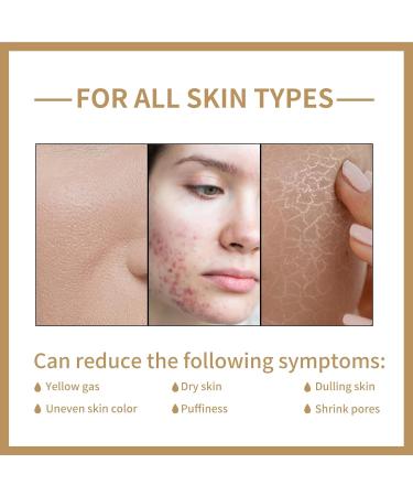 Rice Face Toner Natural Moisturizer Glow Essence Glow Facial Toner Hydrating and Moisturizing Rice Extract Rice Toner for Face Face Toner for Dry Skin Rice Glow Boosting Essence Toner 150ML - Buy Online on GoSupps.com