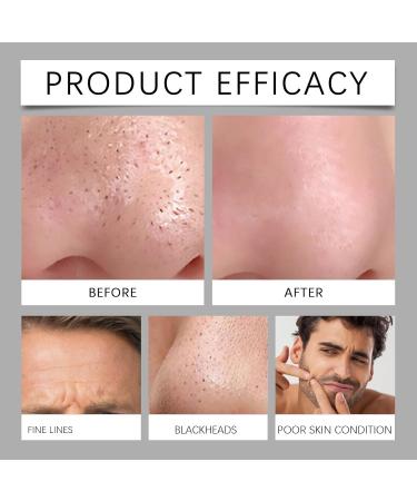  Nurvidis Facial Soap Bread Facial Cleansing Natural Soap Solid Face Cleanser Men Face Soap Cleansing And Moisturizing Soap For Face And Body 2 Pcs - Buy Online on GoSupps.com